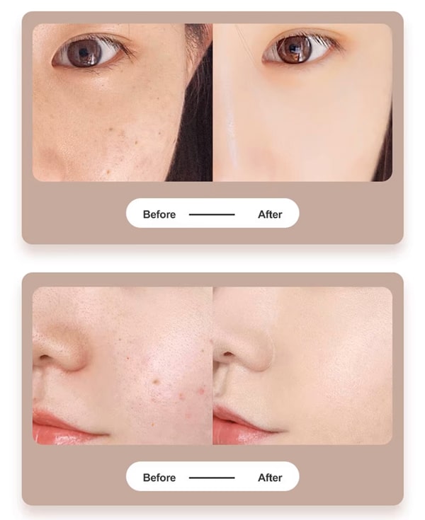 دستگاه بیوتی پن 9 قدرته مدل DZ-01